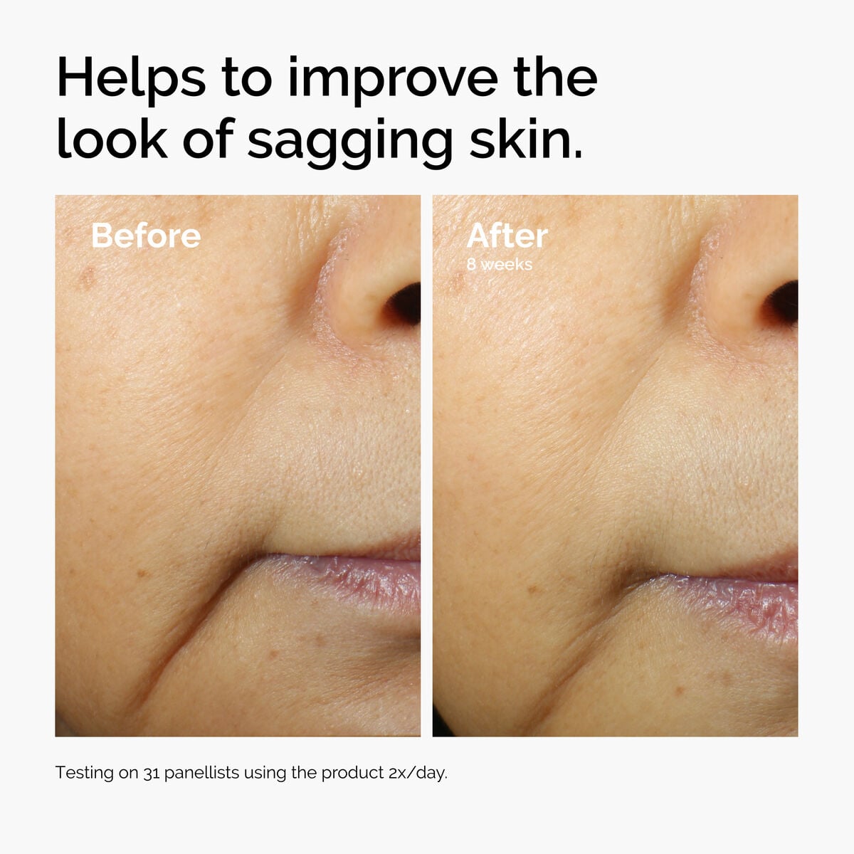 caffeine-3-escin-1-face-serum-x5 ord-caffeine-3pct-escin-1pct-face-serum-before-after-sagging.jpg