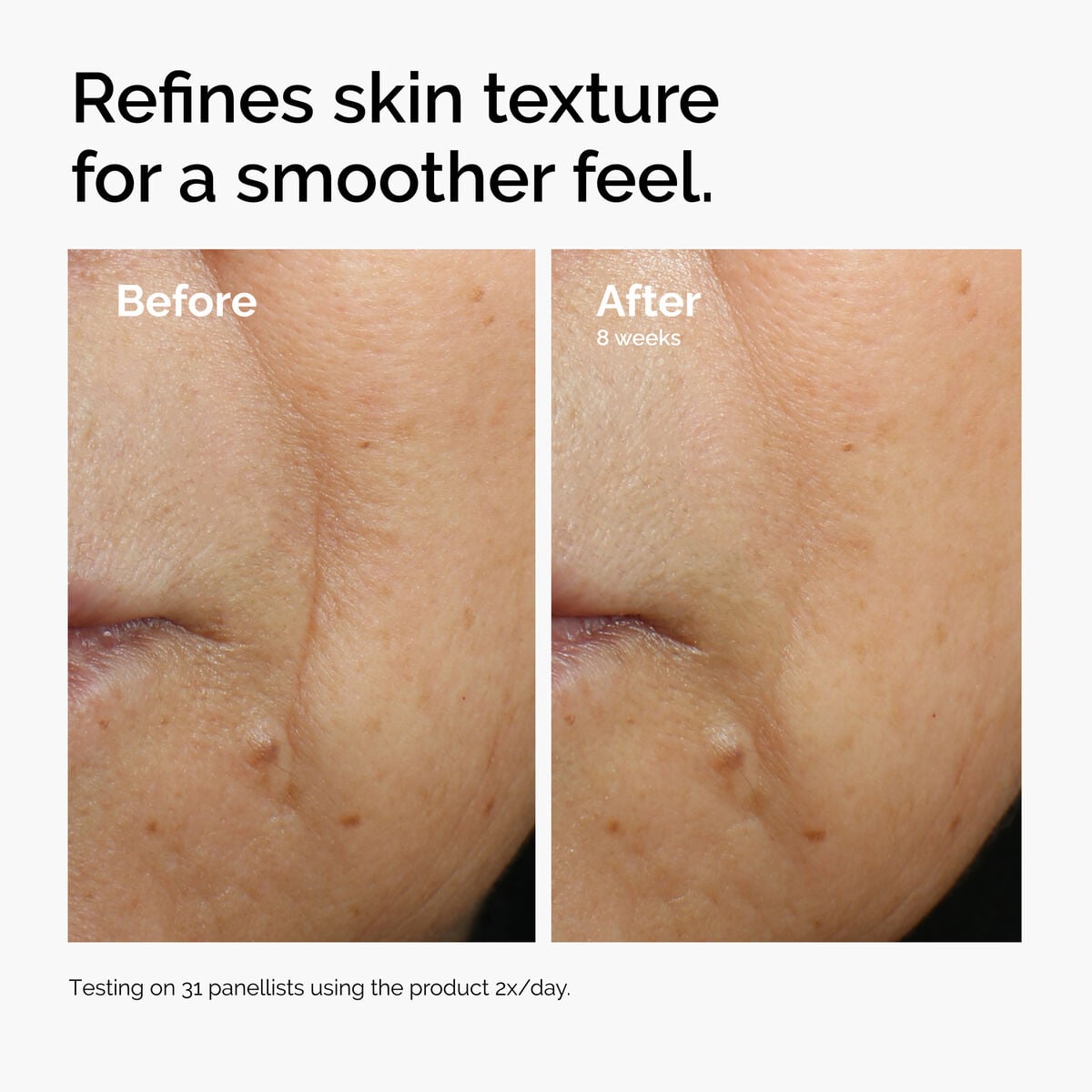 caffeine-3-escin-1-face-serum-x5 ord-caffeine-3pct-escin-1pct-face-serum-before-after-texture.jpg