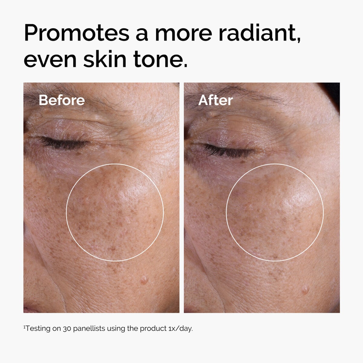 glycolic-acid-7-exfoliating-toner-z7 ord-glycolic-before-after-radiance.jpg