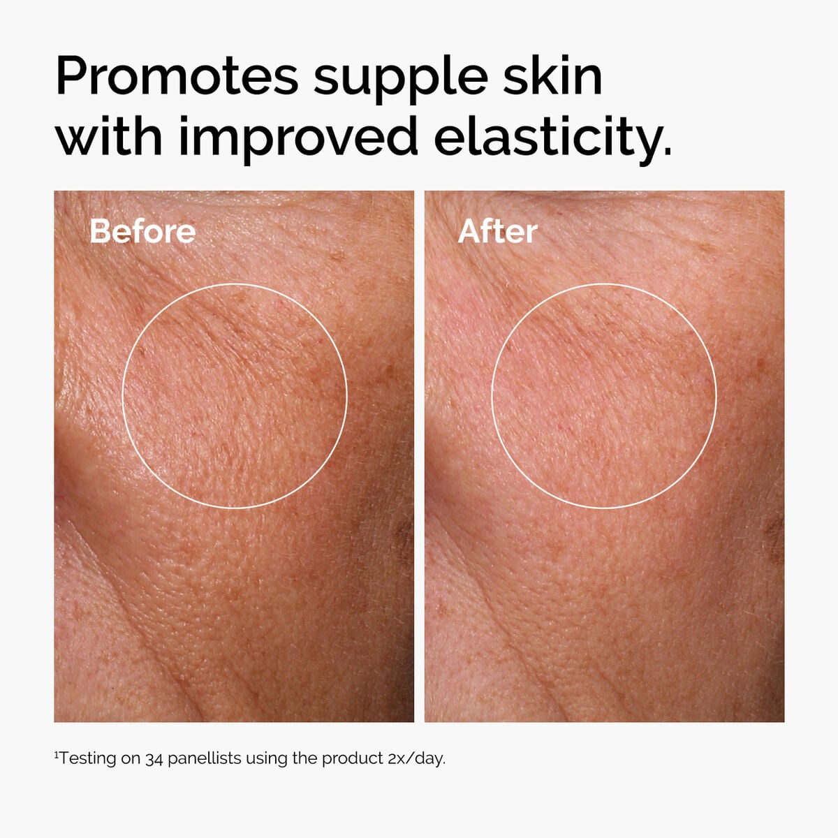 hyaluronic-acid-2-b5-with-ceramides-e3 ord-hyaluronic-acid-2pct-b5-hydrating-serum-before-after-elasticity.jpg