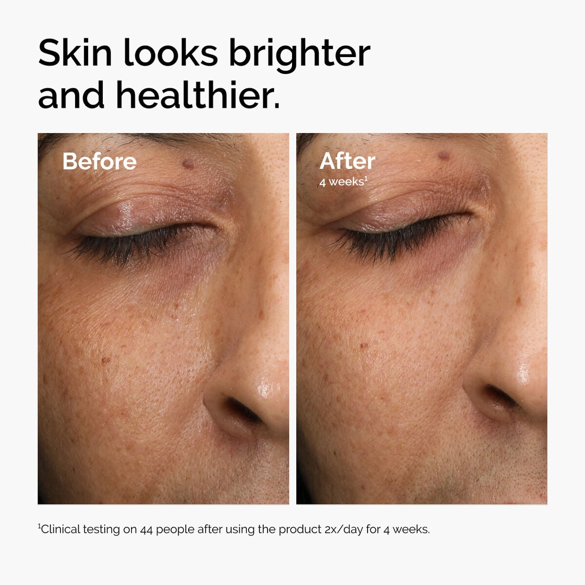 multi-antioxidant-radiance-serum-b6 ord-mars-before-after-healthy.jpg