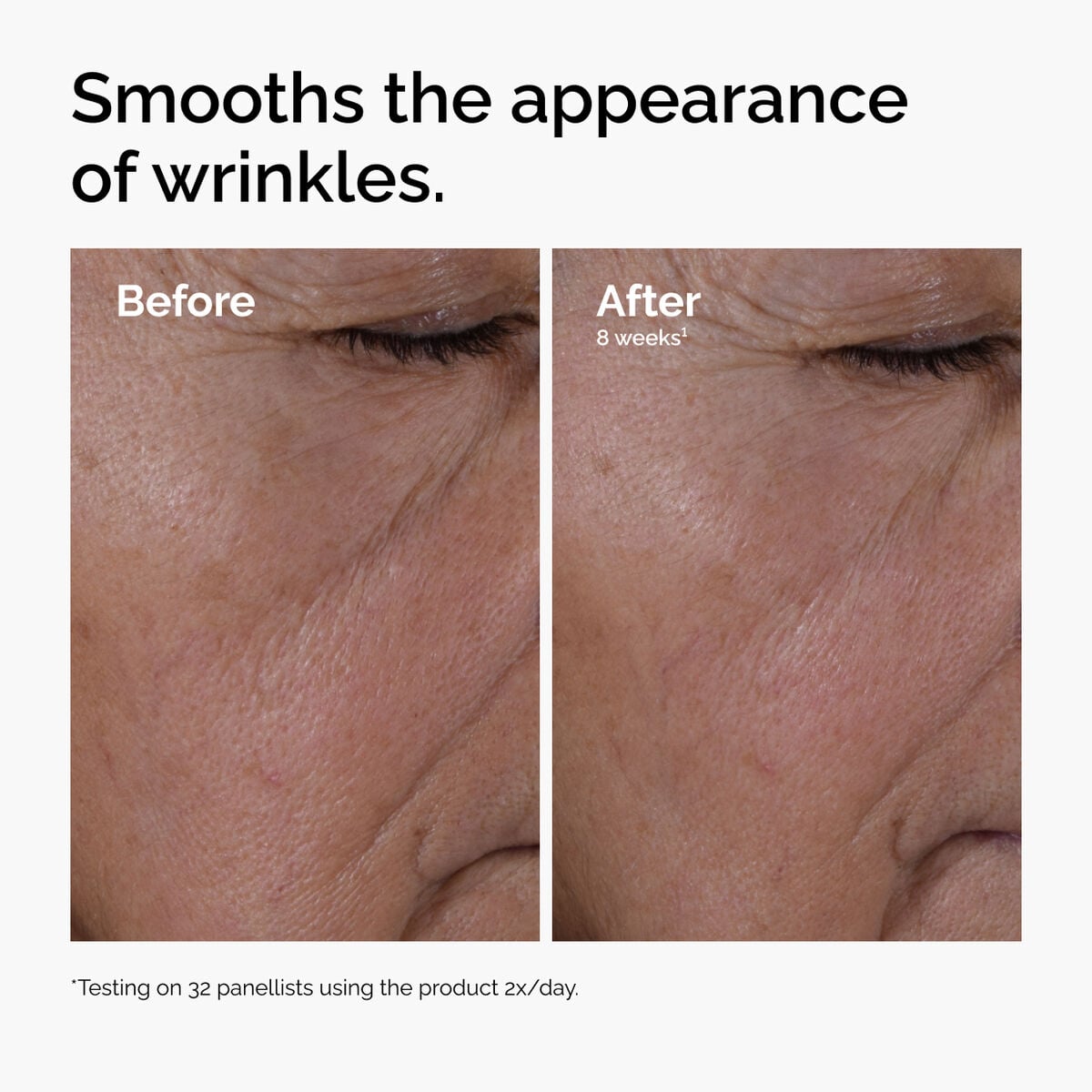 multi-peptide-ha-serum-d7 ord-multi-peptide-ha-serum-wrinkles-before-after.jpg