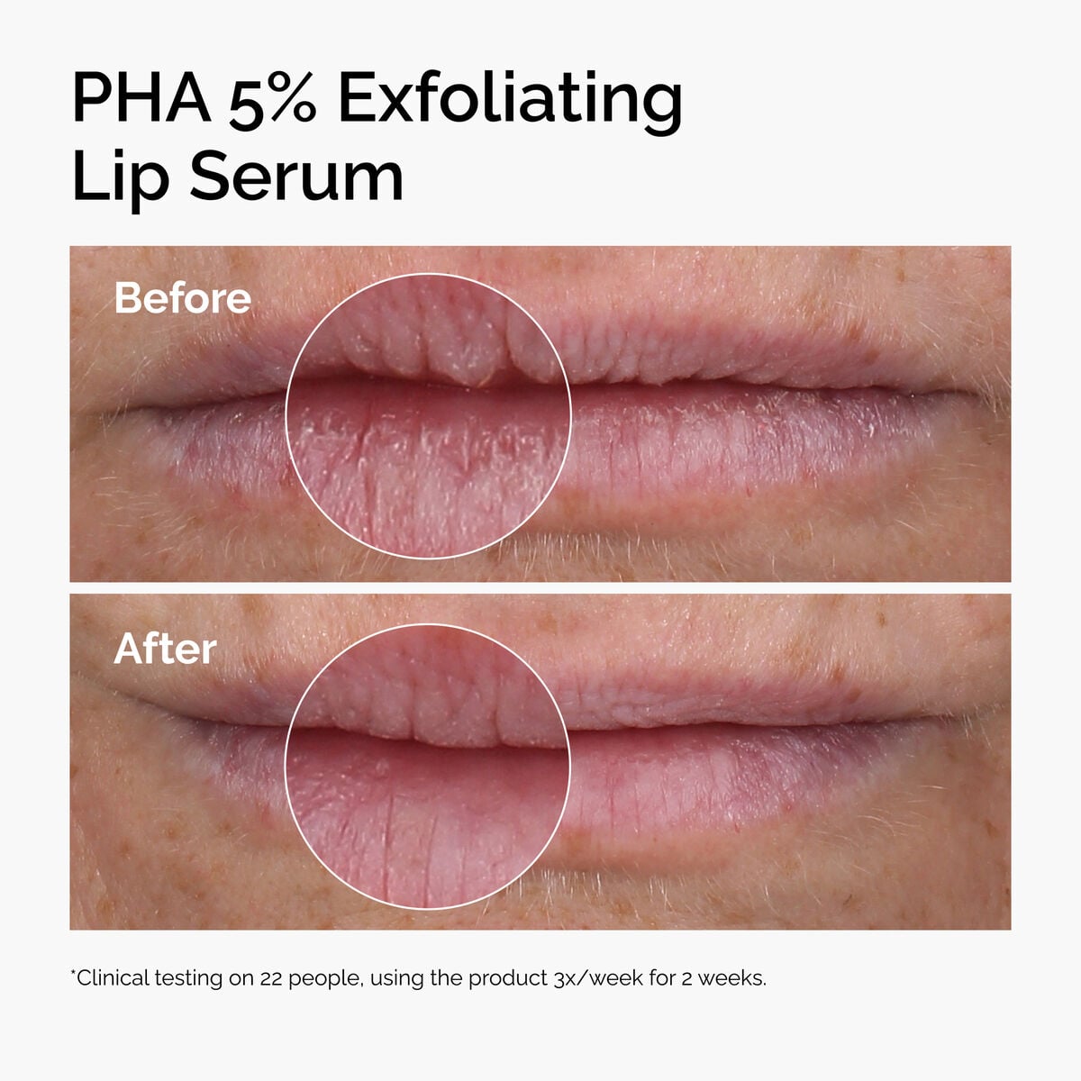 pha-5-exfoliating-lip-serum-l8 ord-pha-5pct-lip-exfoliating-serum-before-after.jpg